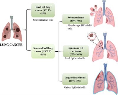 Immunoregulatory framework and the role of miRNA in the pathogenesis of NSCLC – A systematic review